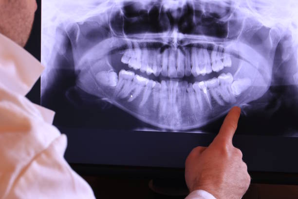 Best Urgent Dental Care for Toothache in Lake Dallas, TX