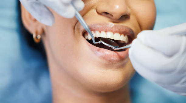 Best Emergency Dental Care for Abscessed Tooth in Lake Dallas, TX